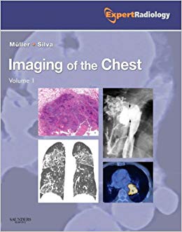 Imaging of the Chest, 2-Volume Set: Expert Radiology Series