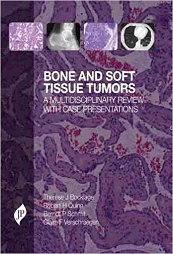 Bone and Soft Tissue Tumours: A Multidisciplinary Review With Case Presentations