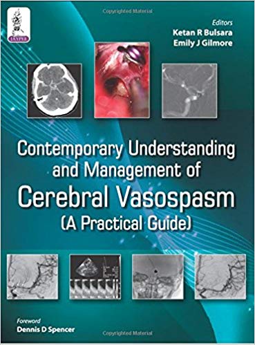 Contemporary Understanding and Management of Cerebral Vasospasm: A Practical Guide
