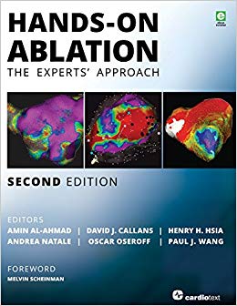 Hands-On Ablation: The Experts