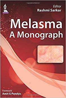 Melasma: A Monograph