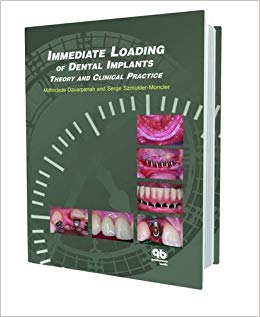 Immediate Loading of Dental Implants: Theory and Clinical Practice