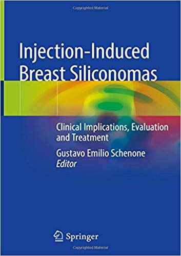 Injection-Induced Breast Siliconomas: Clinical Implications, Evaluation and Treatment