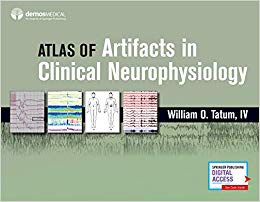 Atlas of Artifacts in Clinical Neurophysiology