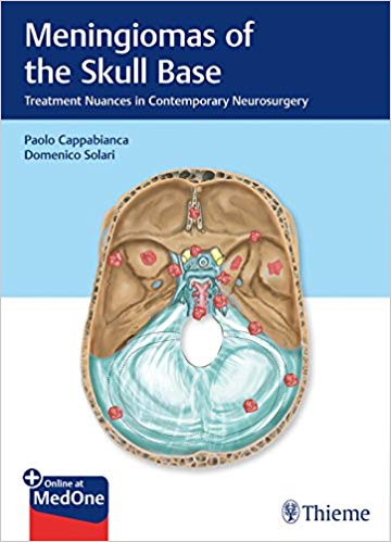 Meningiomas of the Skull Base: Treatment Nuances in Contemporary Neurosurgery