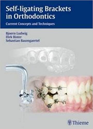Self-ligating Brackets in Orthodontics: Current Concepts and Techniques