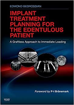
                Implant Treatment Planning for the Edentulous Patient: A Graftless Approach to Immediate Loading
            