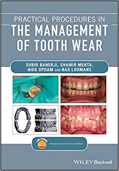 
                Practical Procedures in the Management of Tooth Wear
            