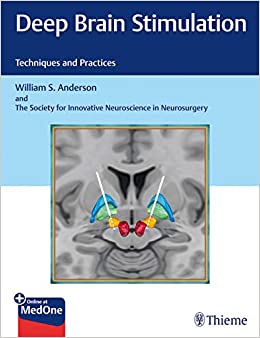 
                Deep Brain Stimulation: Techniques and Practices
            