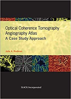 
                Optical Coherence Tomography Angiography Atlas: A Case Study Approach
            