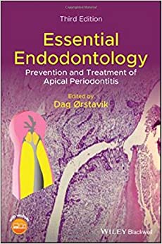 
                Essential Endodontology: Prevention and Treatment of Apical Periodontitis
            