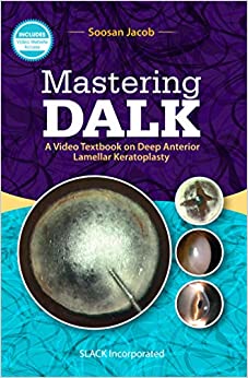 
                Mastering DALK: A Video Textbook on Deep Anterior Lamellar Keratoplasty
            